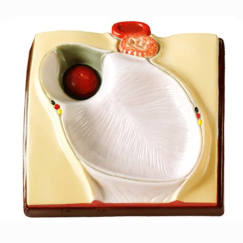 Hjerte m. pericardium - eAnatomi