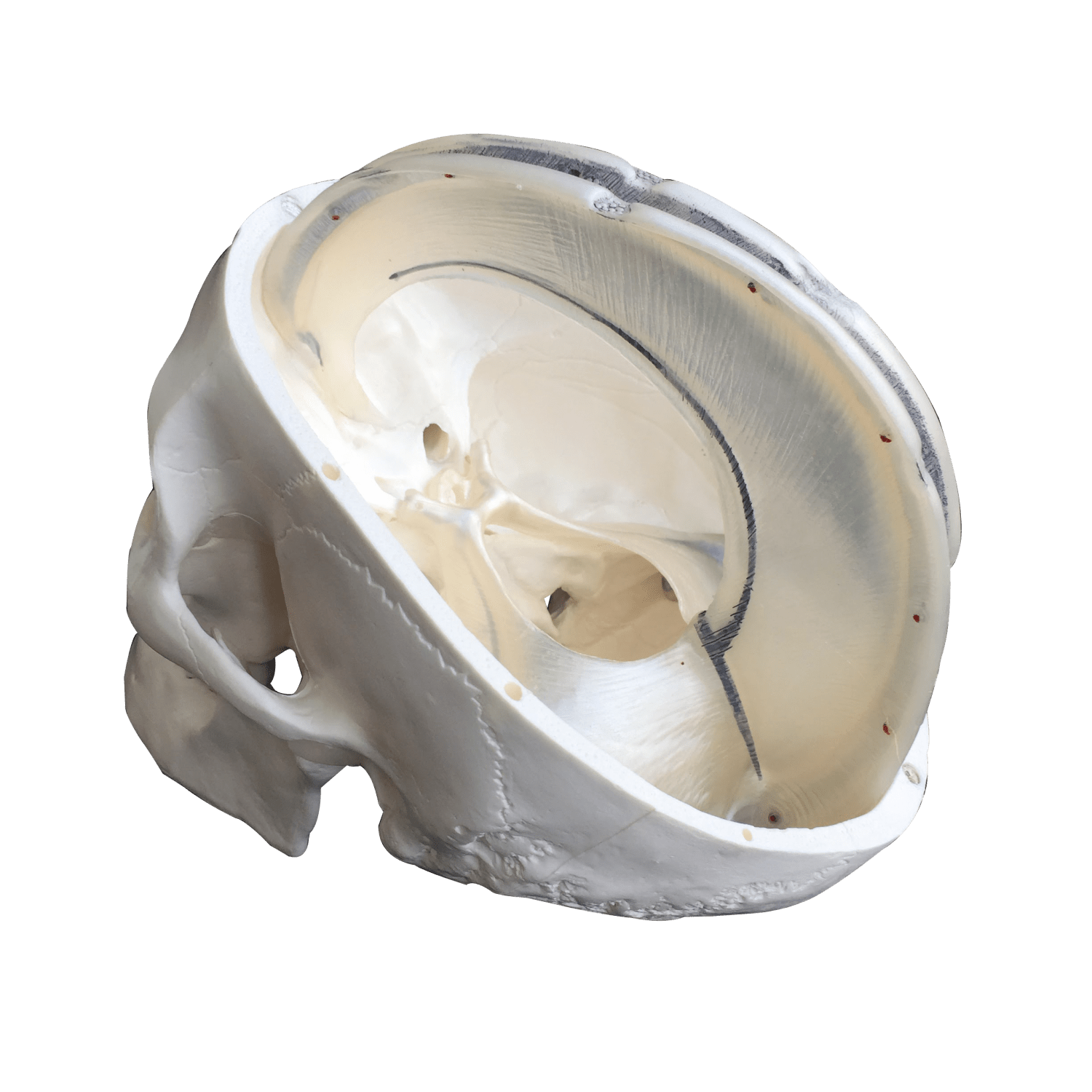 Kranie m. udsnit af dura mater, 2 dele - eAnatomi