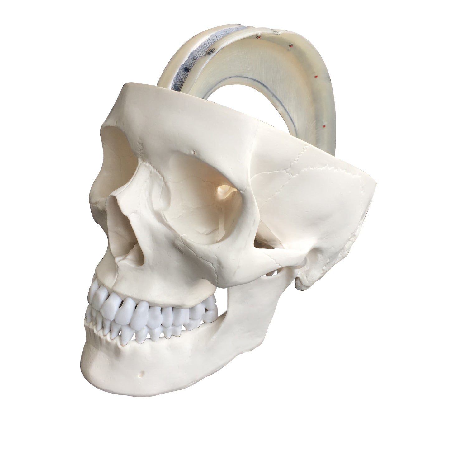 Kranie m. udsnit af dura mater, 2 dele - eAnatomi