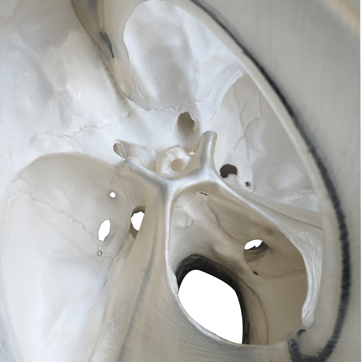 Kranie m. udsnit af dura mater, 2 dele - eAnatomi