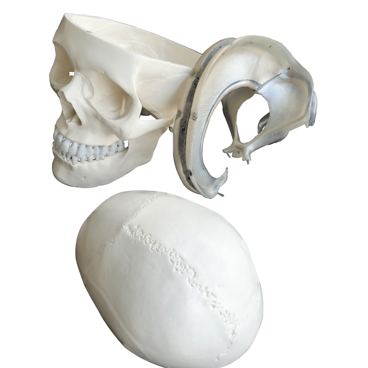 Kranie m. udsnit af dura mater, 2 dele - eAnatomi