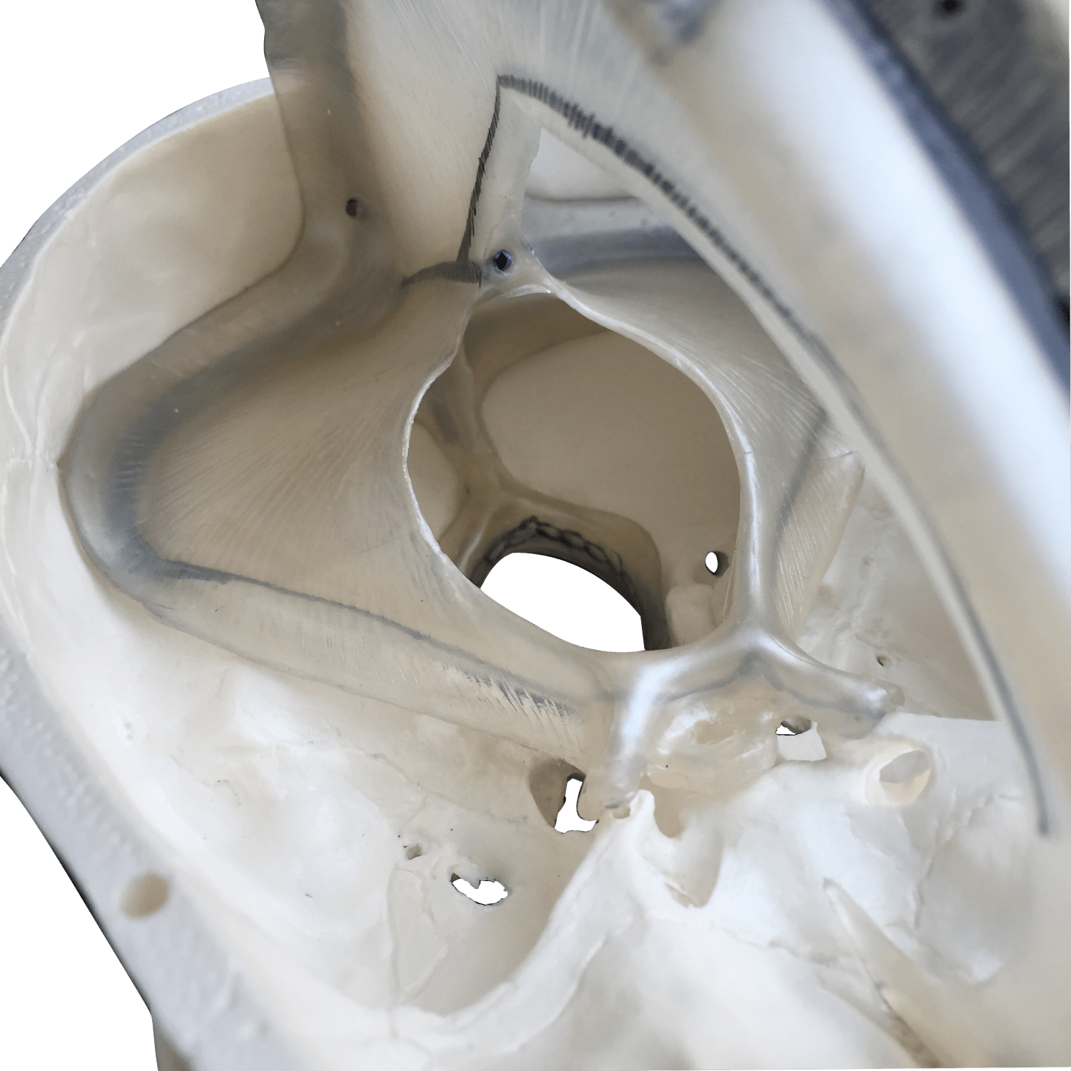 Kranie m. udsnit af dura mater, 2 dele - eAnatomi