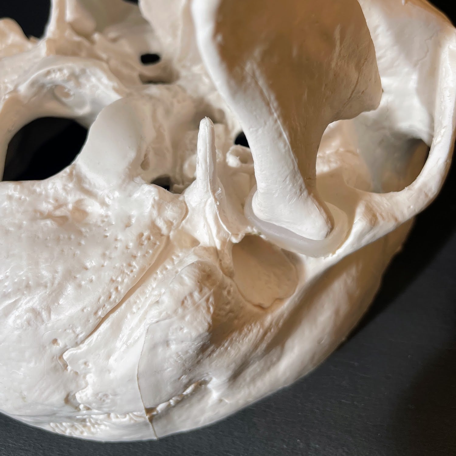 Standard kranie, 2 dele - eAnatomi