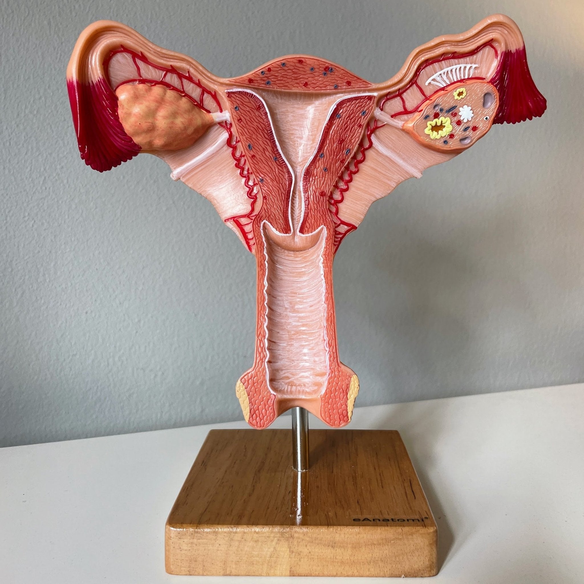 Livmoder m. æggestokke - eAnatomi