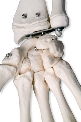 Robust skelet, 177 cm - eAnatomi