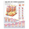 plakat om huden og almindelige hudlidelser på engelsk - eAnatomi