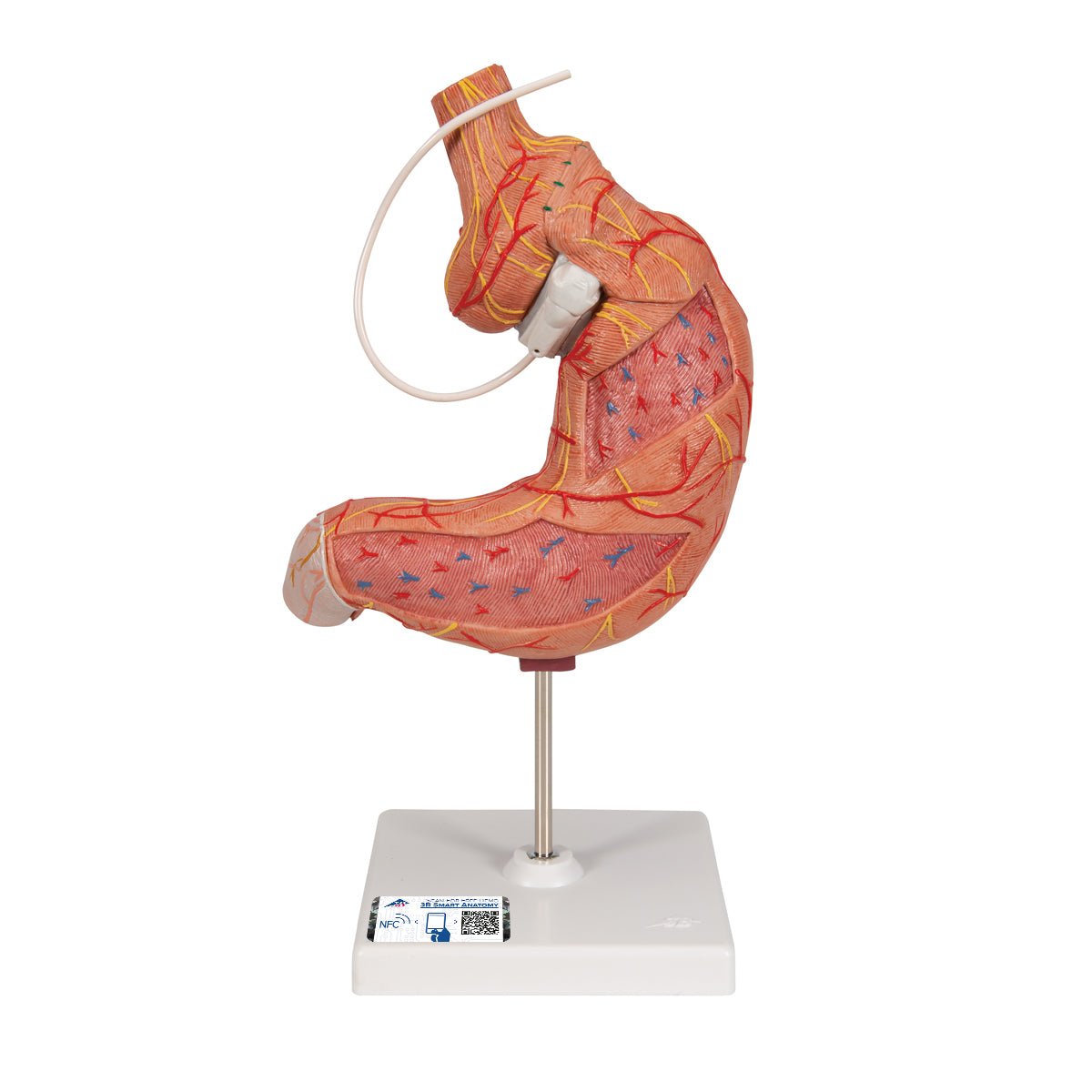 Mavesæk m. gastrisk banding - eAnatomi