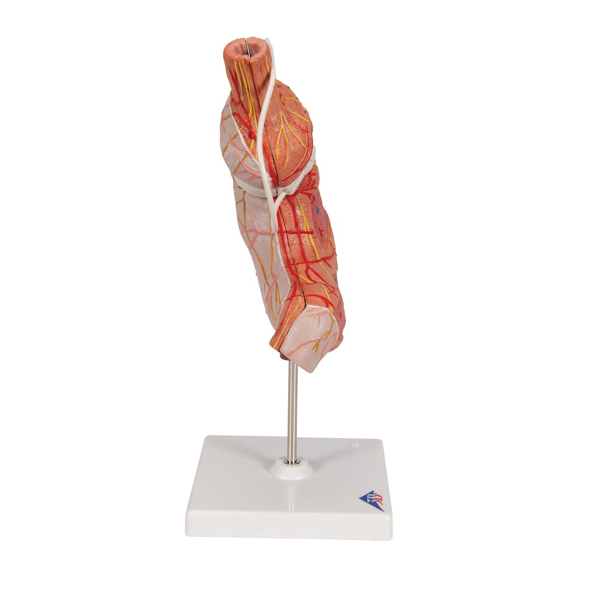 Mavesæk m. gastrisk banding - eAnatomi