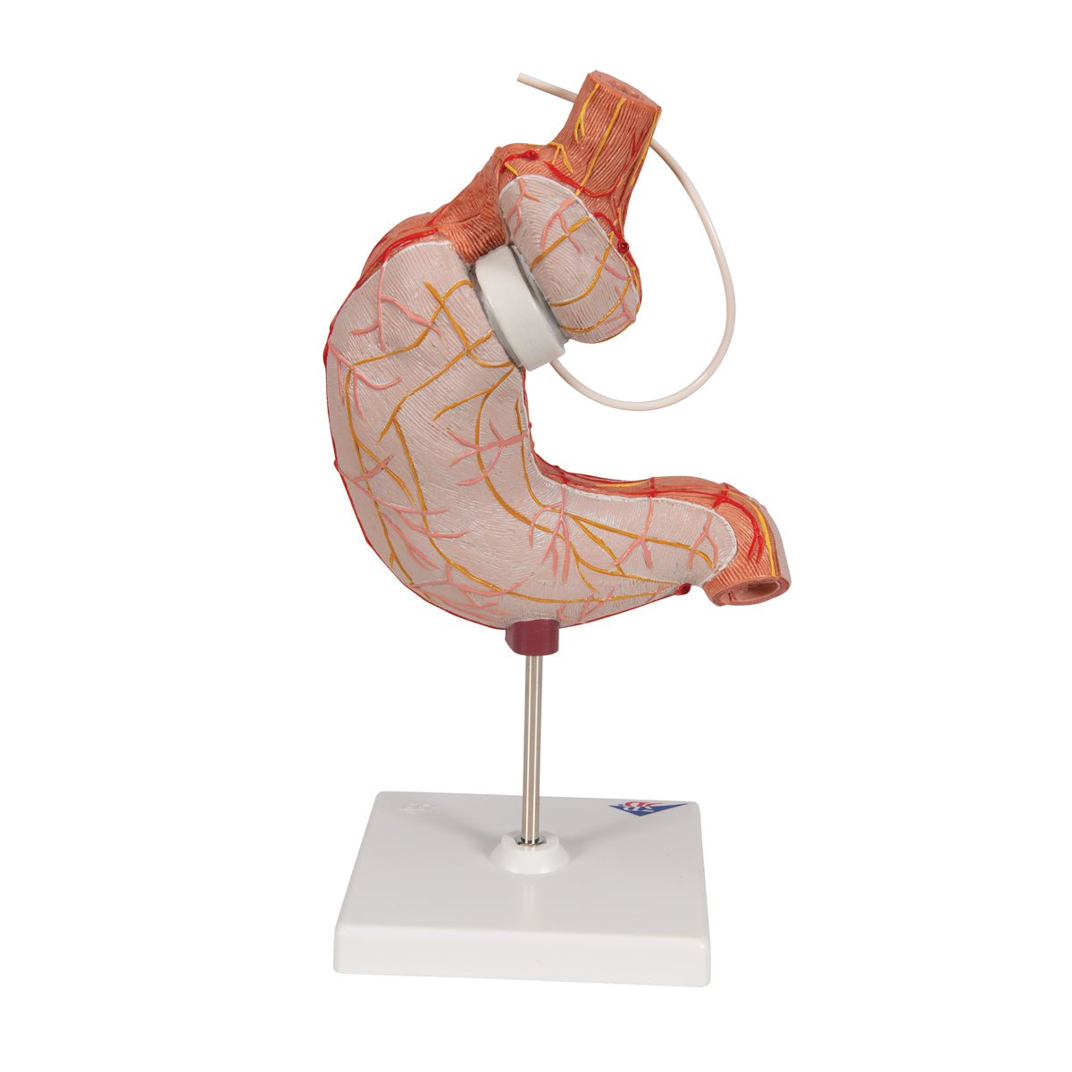 Mavesæk m. gastrisk banding - eAnatomi