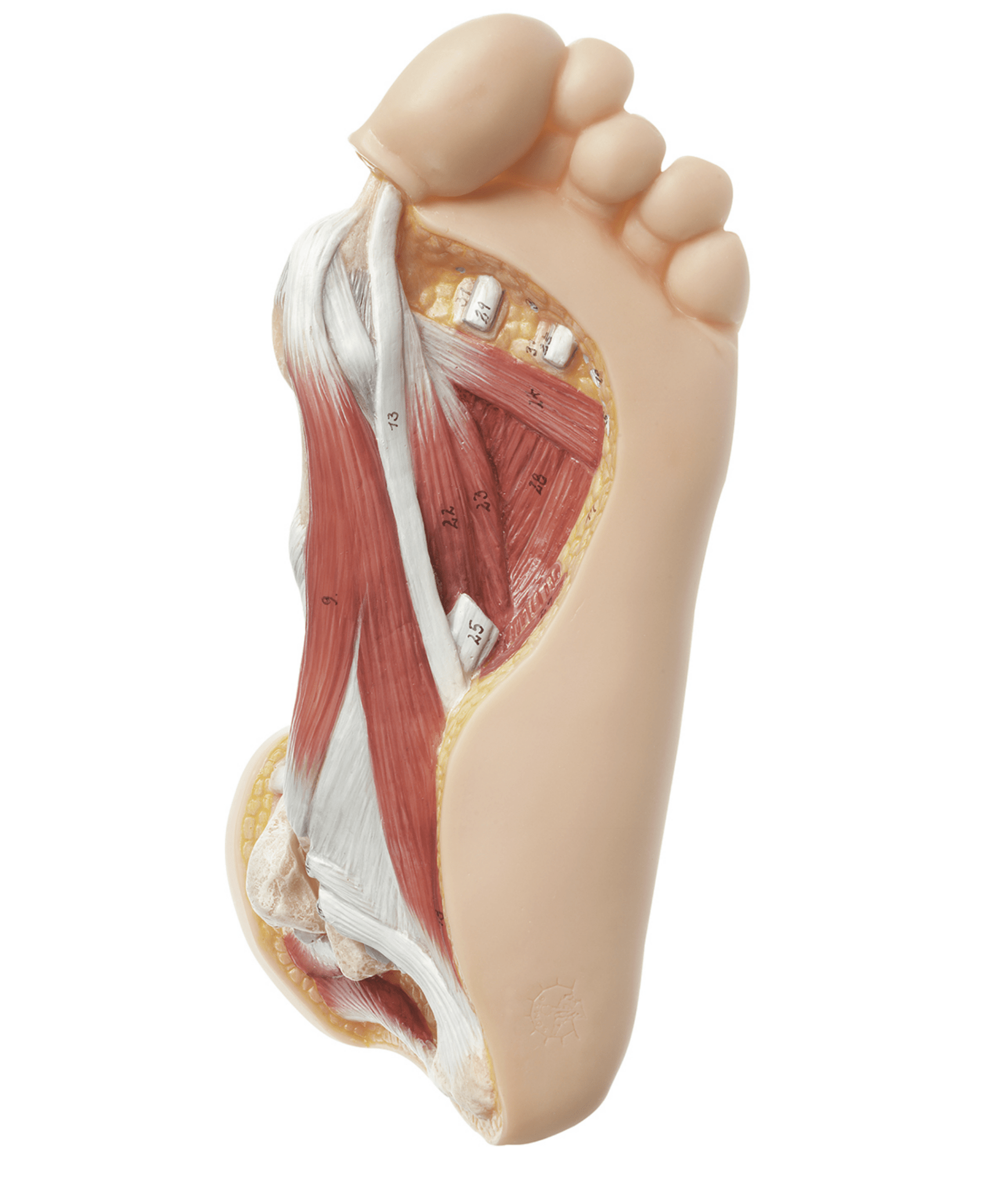 Fod m. hallux valgus - eAnatomi