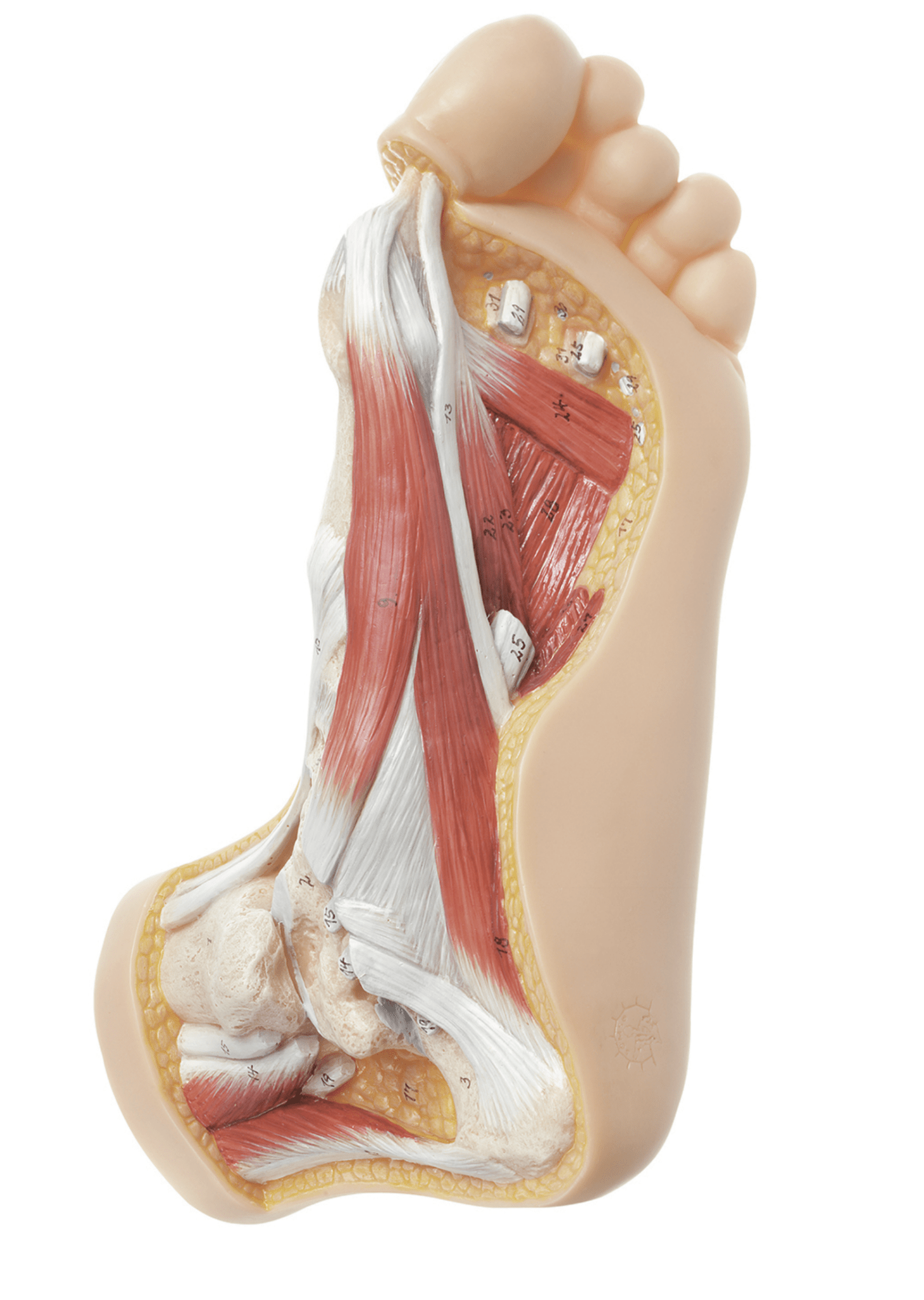 Fod m. hallux valgus - eAnatomi
