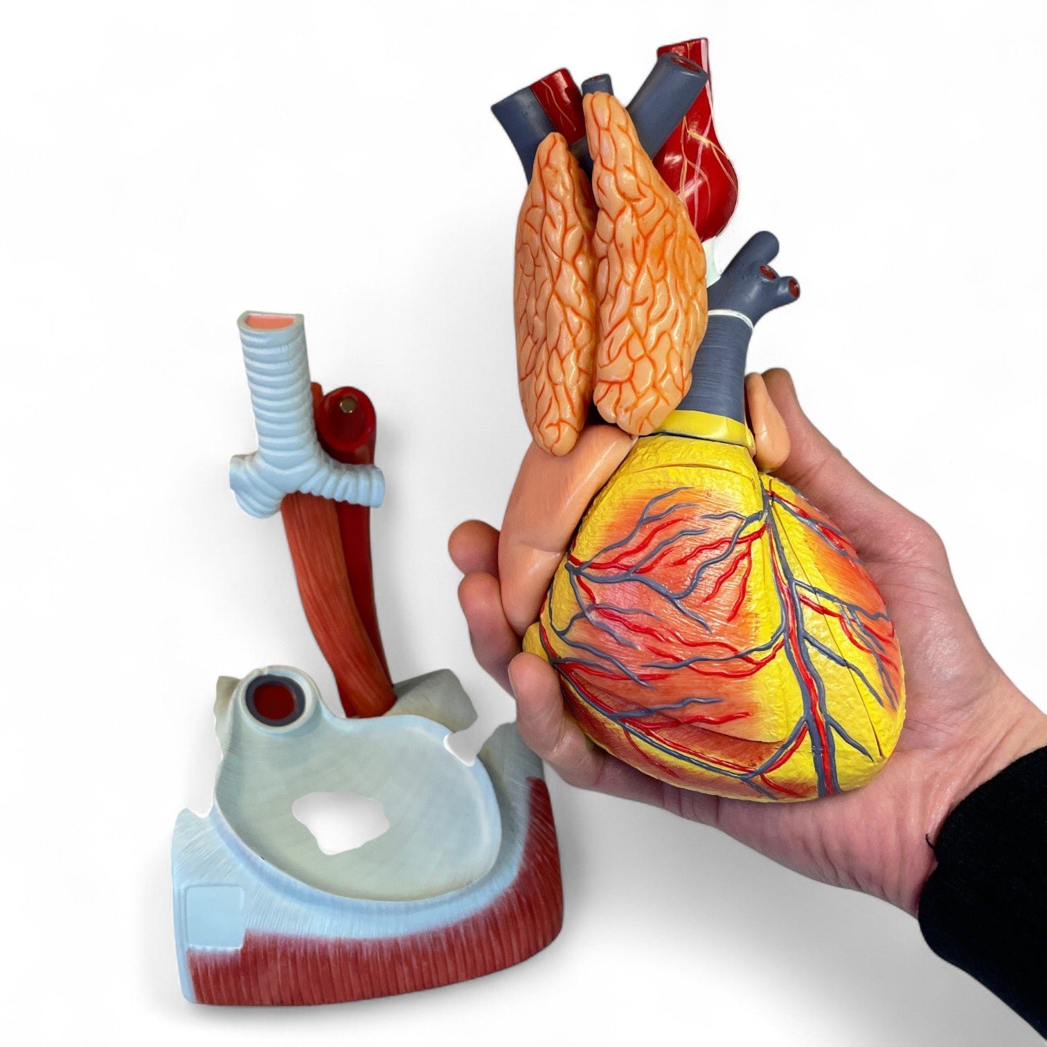 Enlarged heart model in high quality and 12 parts