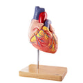 Forstørret hjertemodel - eAnatomi