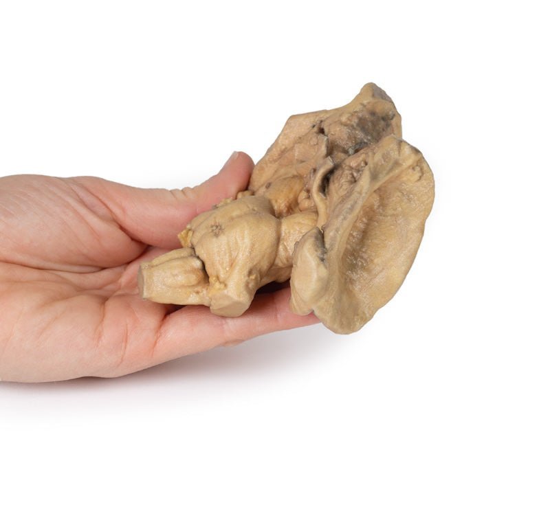 Hjernestamme m. dybe strukturer fra cerebrum og diencephalon - eAnatomi