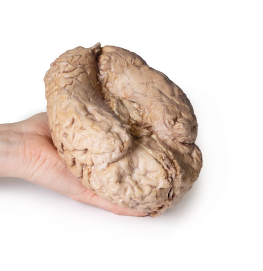 Hjerne (Cerebrum)