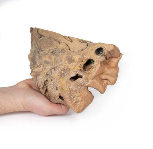 Bihulerne m. deres forbindelser til næsehulen - eAnatomi