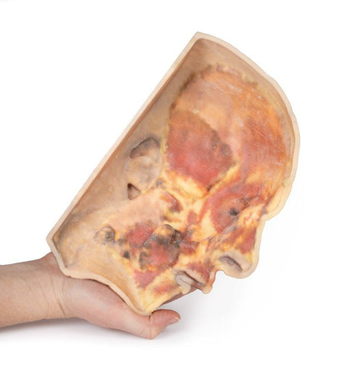 Ansigt m. superficielle strukturer - eAnatomi