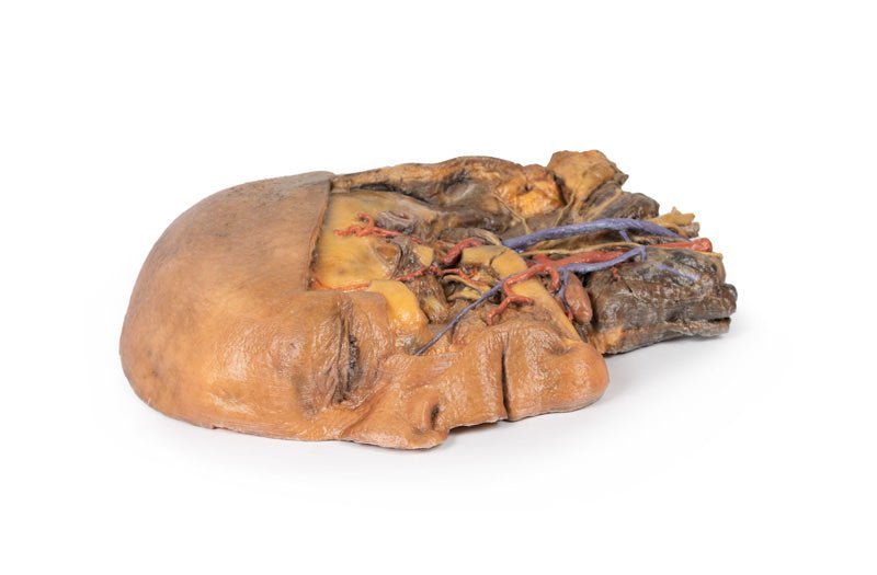 Sagittal section of the head and neck – fossa and vagina