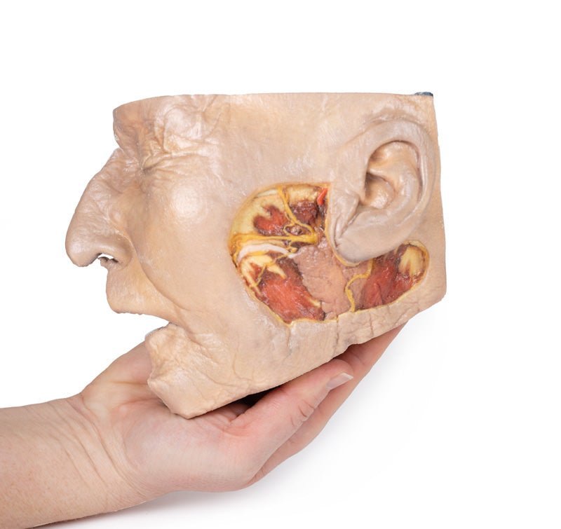 Fridissektion af glandula parotidea og n. facialis - eAnatomi