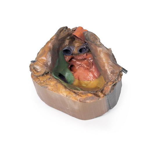 Perikardiet