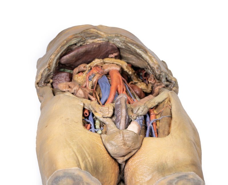 Abdomen m. bilaterale hernier - eAnatomi