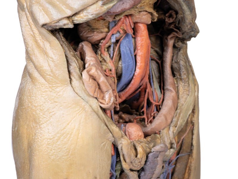 Abdomen m. bilaterale hernier - eAnatomi