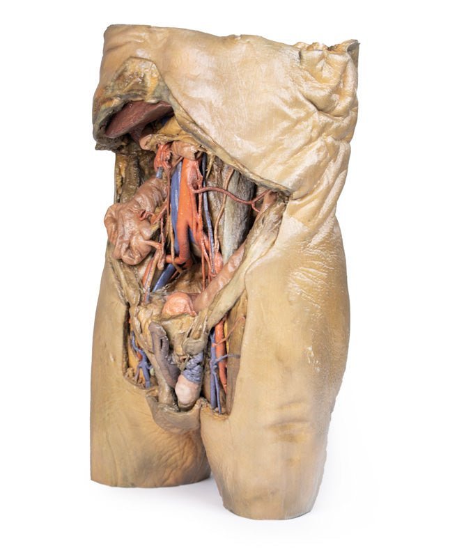 Abdomen m. bilaterale hernier - eAnatomi