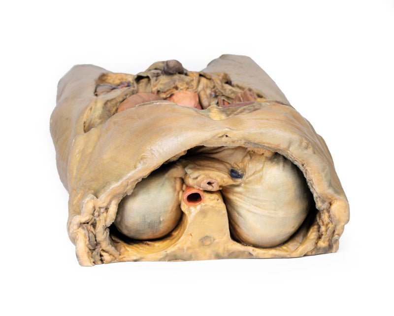 Abdomen m. bilaterale hernier - eAnatomi