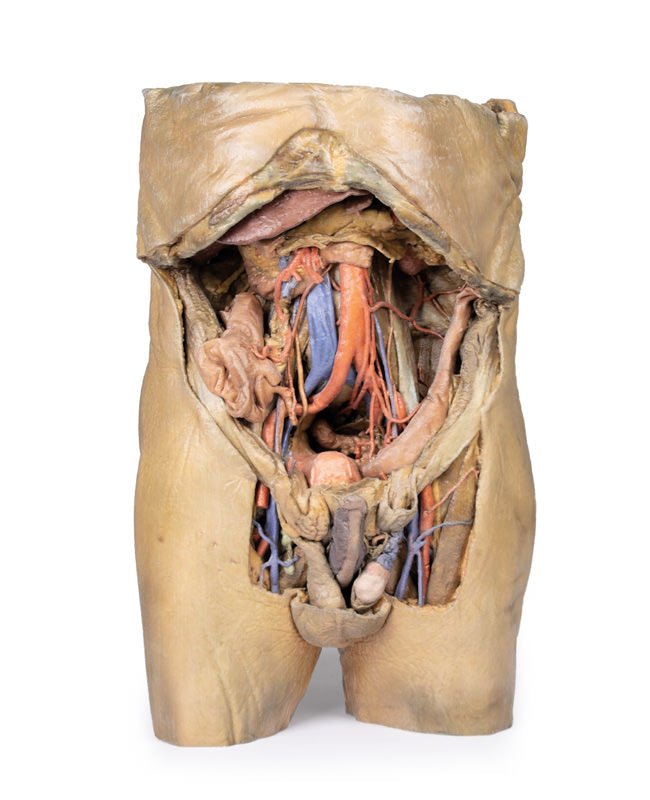 Abdomen m. bilaterale hernier - eAnatomi