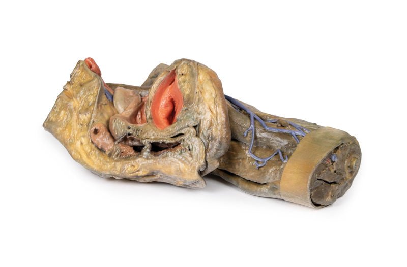 Del af Kvindens pelvis og lår - eAnatomi