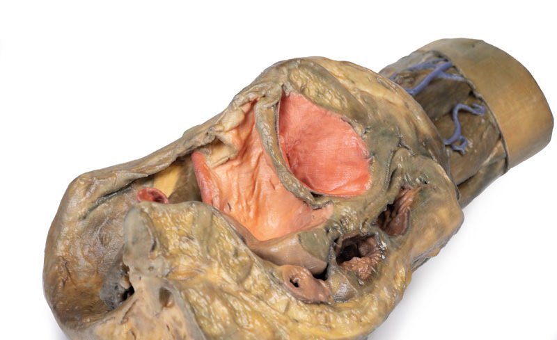 Del af Kvindens pelvis og lår - eAnatomi