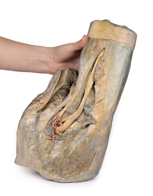 Del af Kvindens pelvis og lår