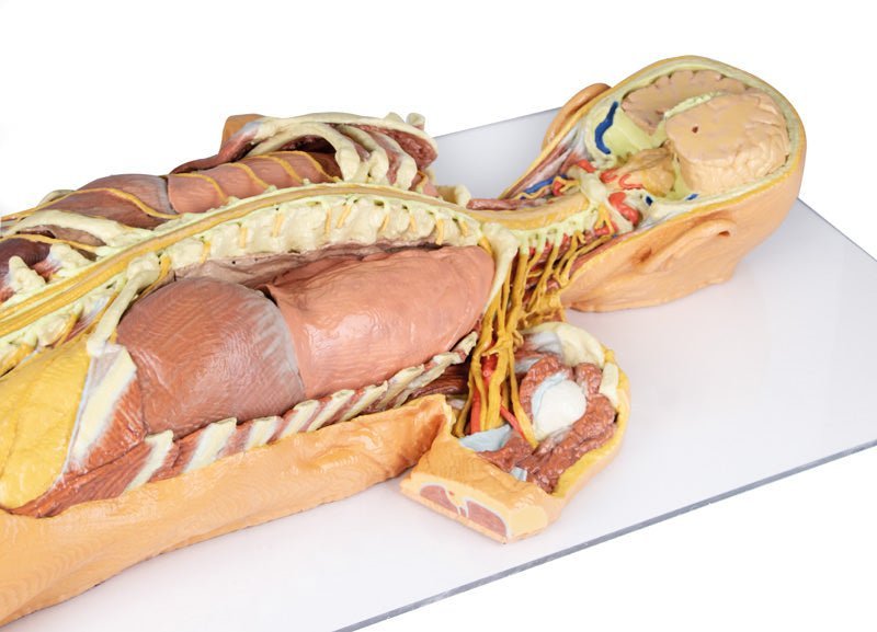 Fridissektion af nervesystem (posteriort) - eAnatomi