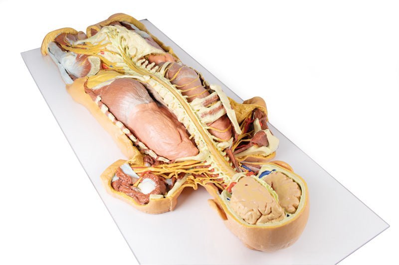 Fridissektion af nervesystem (posteriort) - eAnatomi