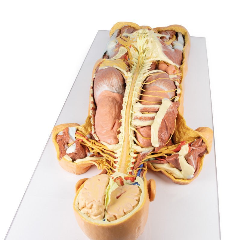 Fridissektion af nervesystem (posteriort) - eAnatomi