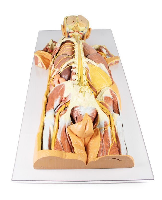 Fridissektion af nervesystem (posteriort) - eAnatomi