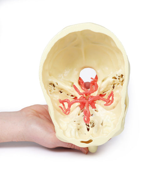 Circle of Willis