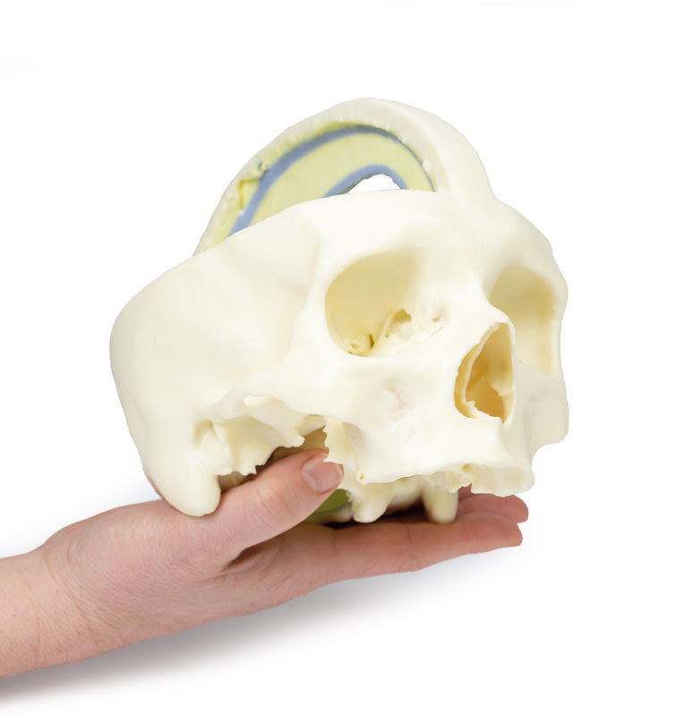 Dural kranium
