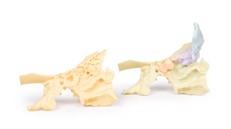 Paranasal Sinus model