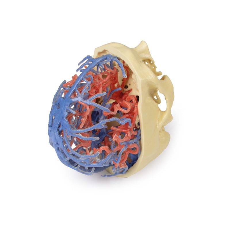 Kraniets arterie - og venesystem - eAnatomi