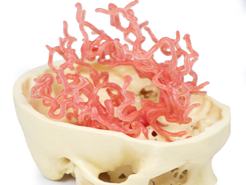 Arteriel cirkulation