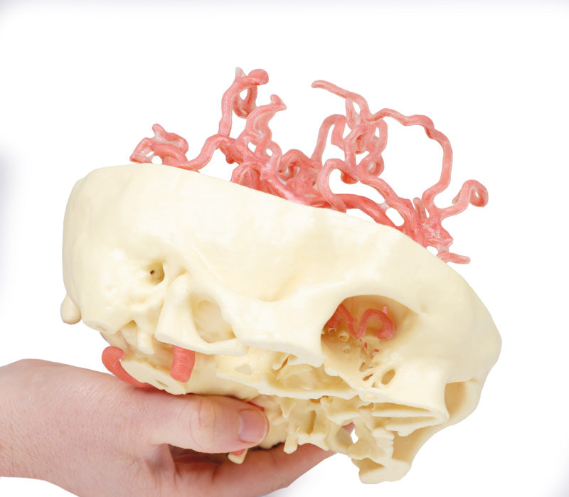 Arteriel cirkulation