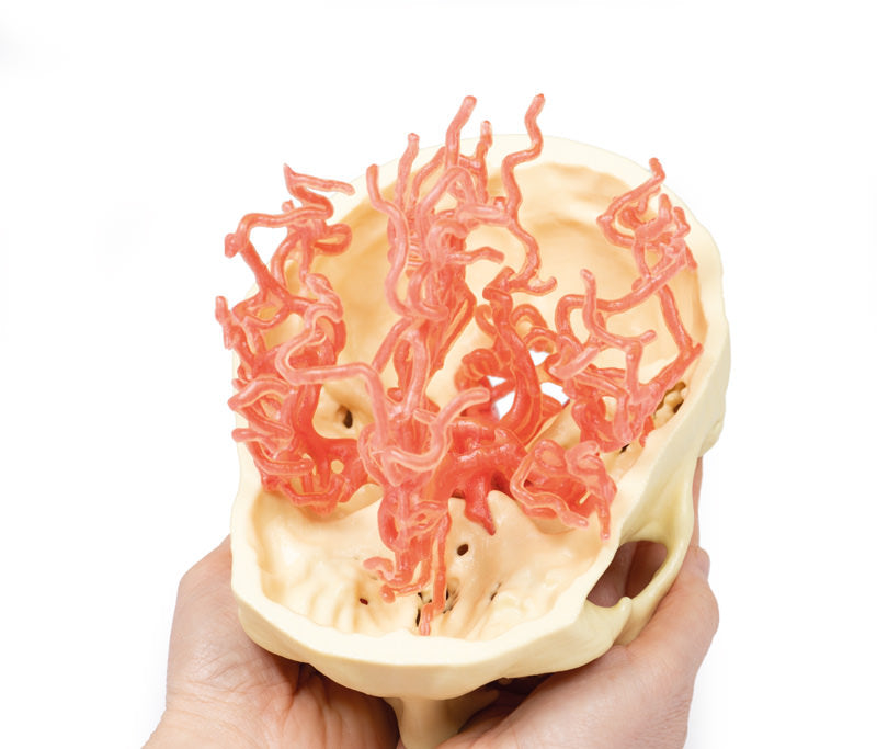Arteriel cirkulation