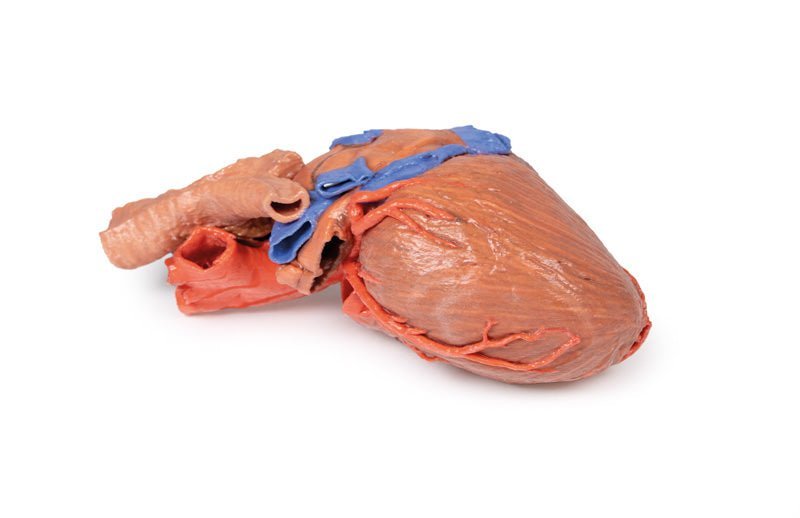 Hjerte m. distale trachea, carina og primære bronkier - eAnatomi