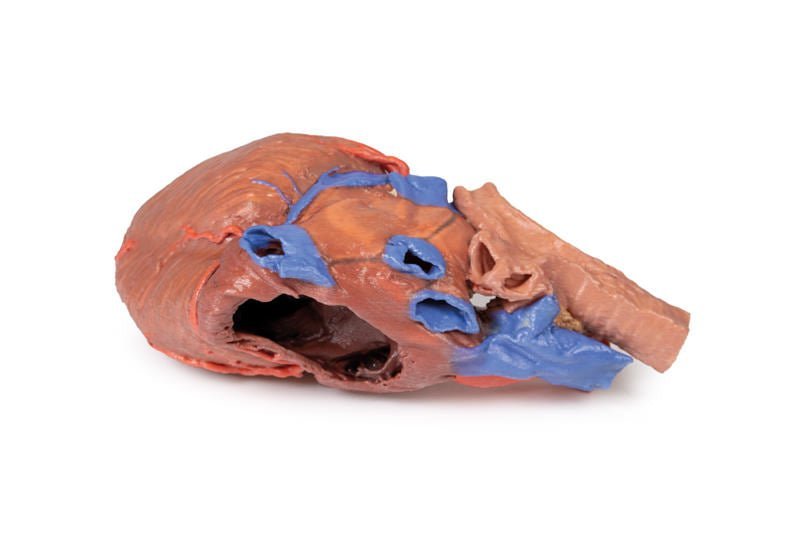 Hjerte m. distale trachea, carina og primære bronkier - eAnatomi
