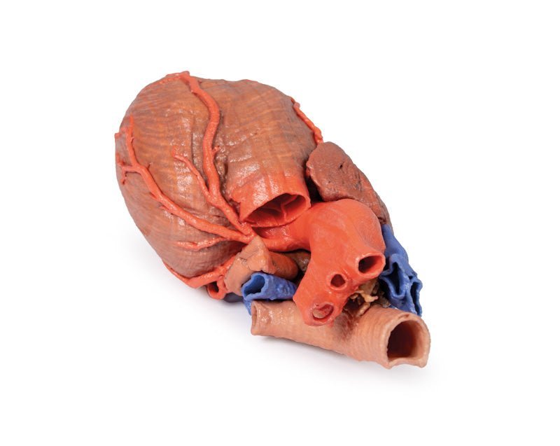 Hjerte m. distale trachea, carina og primære bronkier - eAnatomi