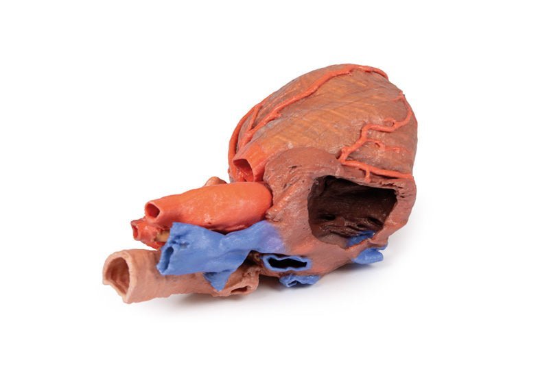 Hjerte m. distale trachea, carina og primære bronkier - eAnatomi