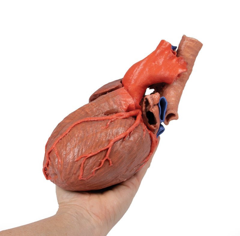 Hjerte m. distale trachea, carina og primære bronkier - eAnatomi