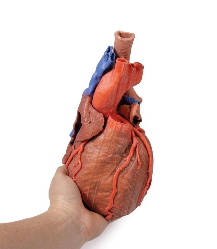 Hjerte m. distale trachea, carina og primære bronkier - eAnatomi