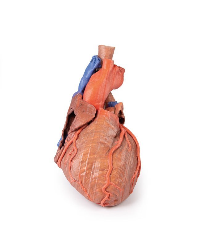 Hjerte m. distale trachea, carina og primære bronkier - eAnatomi